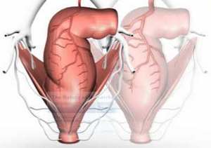 hemorrhoid treatment system